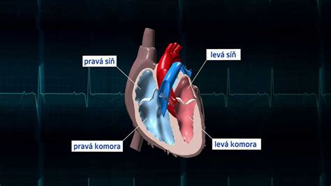 Schematické znázornenie zdravého srdca a srdca postihnutého kardiomyopatiou