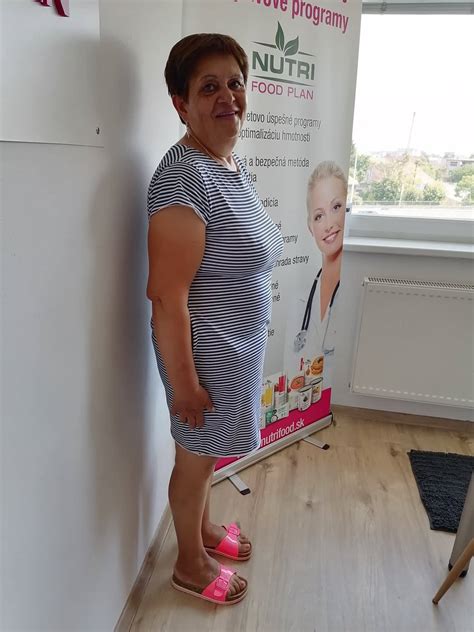 Ilustračná fotografia osoby konzultujúcej s výživovým poradcom