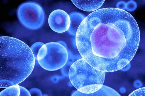 Infografika vysvetľujúca mechanizmus pôsobenia ultrazvuku na tukové bunky