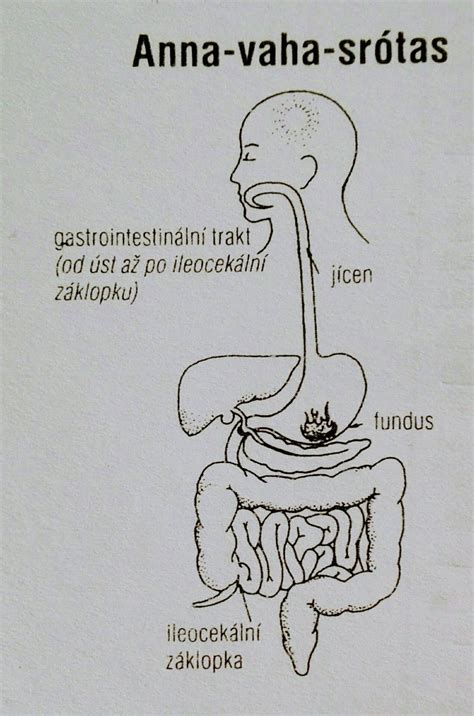 Ilustrácia tráviaceho systému s vyznačeným tenkým a hrubým črevom