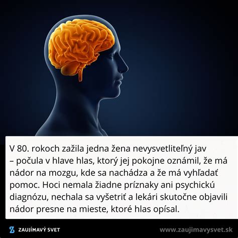 Ilustrácia mozgu s označením centier zodpovedných za reguláciu hladu.