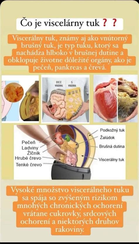 Vizualizácia viscerálneho tuku obklopujúceho orgány v brušnej dutine