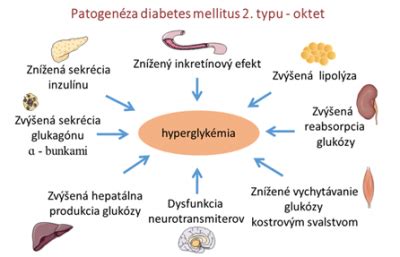 schéma znázorňujúca patofyziologické mechanizmy diabetes mellitus 2. typu