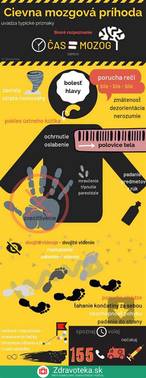 infografika zobrazujúca typické príznaky mononukleózy