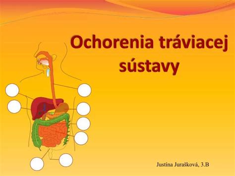 Ilustrácia tráviacej sústavy s vyznačenými možnými problémami
