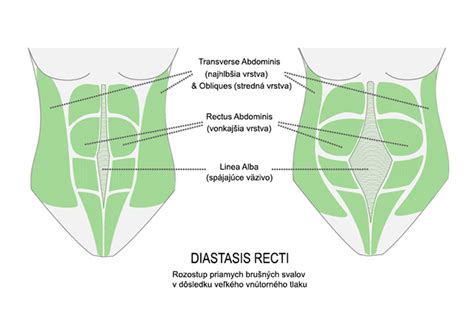 Ilustrácia anatomickej stavby brušných svalov