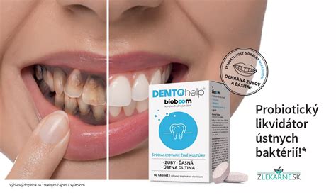 Schéma znázorňujúca ústnu dutinu s vyznačenými oblasťami, kde môže propolis pomôcť: ďasná, sliznica úst, zuby.