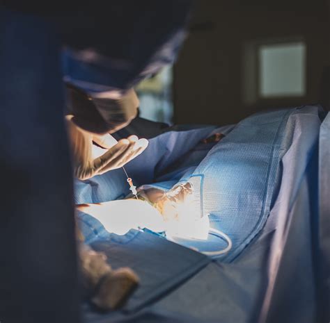 Detailný pohľad na kanylu používanú pri liposukcii, ktorá je zavedená cez malý rez na odstránenie tukových buniek.