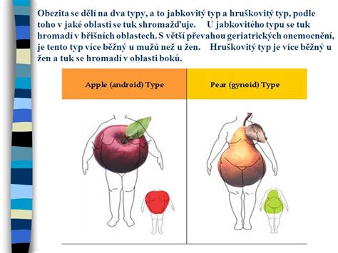 schematické znázornenie androidnej obezity (typ jablko)