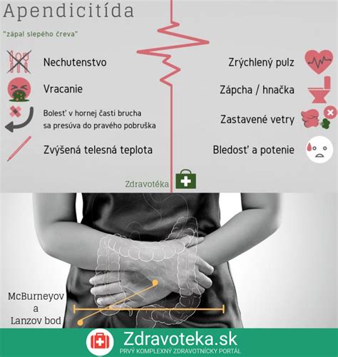 Anatomické znázornenie apendixu a slepého čreva