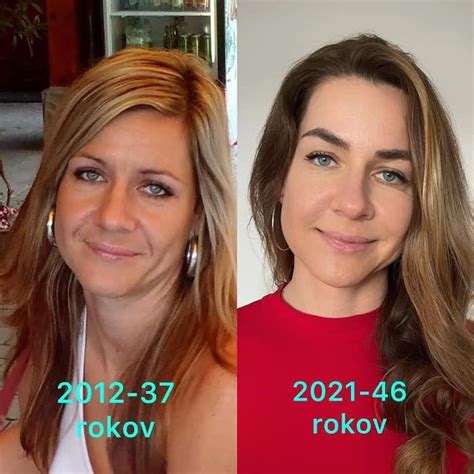 vizualizácia tvárovej kontúry pred a po