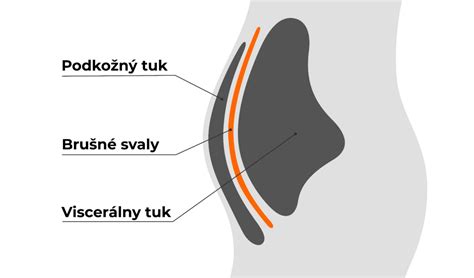 Ilustrácia porovnávajúca ukladanie podkožného a viscerálneho tuku.
