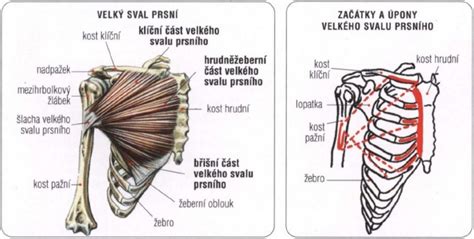Schéma umiestnenia prsného implantátu pod sval