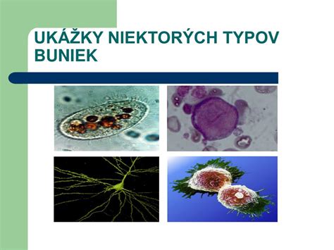 Ilustrácia zobrazujúca rozloženie rôznych typov tukových buniek v tele.