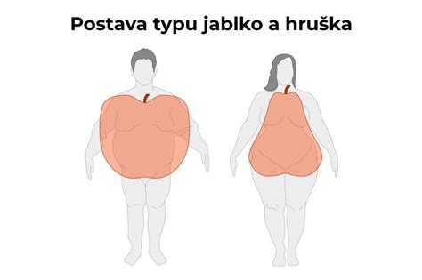Ilustrácia znázorňujúca ukladanie tukového tkaniva v oblasti brucha (androidná obezita) a bokov/stehien (gynoidná obezita).