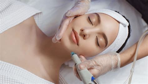 Schéma aplikácie mezoterapie s tvorbou mikrokanálikov.