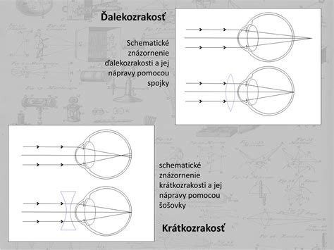 Schematické znázornenie bariatrického zákroku