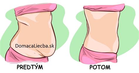 Ilustrácia znázorňujúca typické ukladanie tuku na bruchu u mužov a žien.