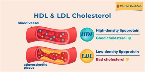 graf zobrazujúci vplyv aktívneho uhlia na hladinu LDL a HDL cholesterolu