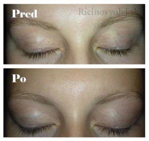 infografika s návodom na použitie ricínového oleja na rast mihalníc a obočia