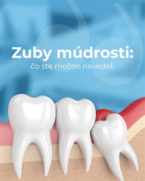 Infografika s porovnaním bežných mýtov a faktov o metabolizme