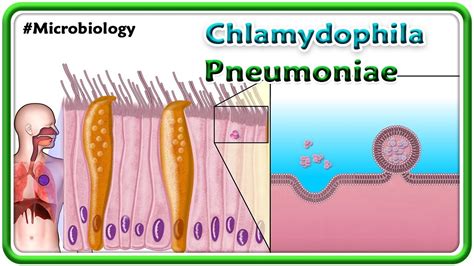 schematické znázornenie baktérie Chlamydophila pneumoniae vo vnútri hostiteľskej bunky
