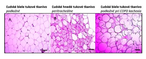 vizualizácia účinku HIFEM technológie na svaly a tukové tkanivo