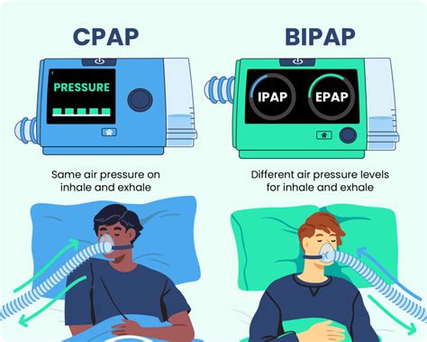 Obrázok znázorňujúci rôzne typy masiek na CPAP a BiPAP terapiu.