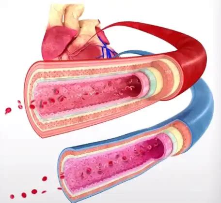 Ilustrácia znázorňujúca rozdiely medzi inzulín-dependentným a inzulín-ne-dependentným diabetom.
