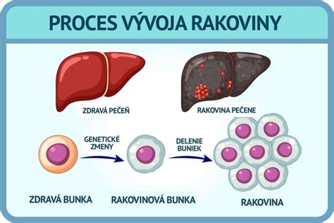 Infografika zobrazujúca proces detoxikácie pečene a jej vplyv na metabolizmus