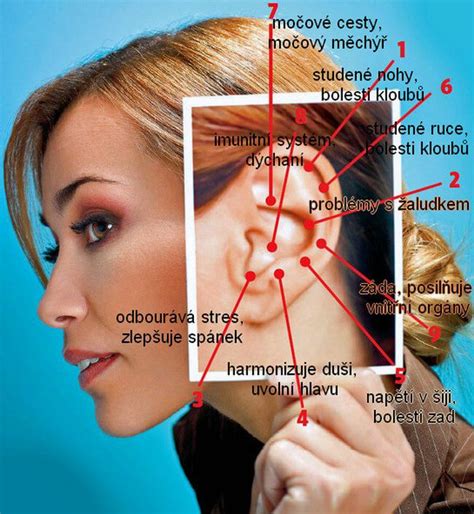 Tematické foto: Akupunktúrne ihličky na uchu