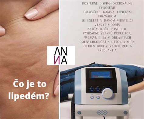 Schéma ultrazvukovej liposukcie a kavitácie