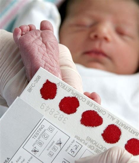 Tematická fotografia: Odber suchej kvapky krvi z pätičky novorodenca