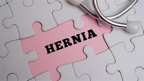 ilustračné foto: osoba s EMS elektródami na bruchu