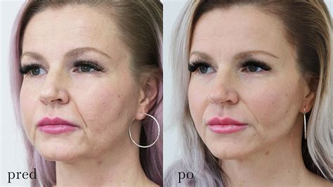 Koláž usmievajúcich sa spokojných klientov pred a po transformácii