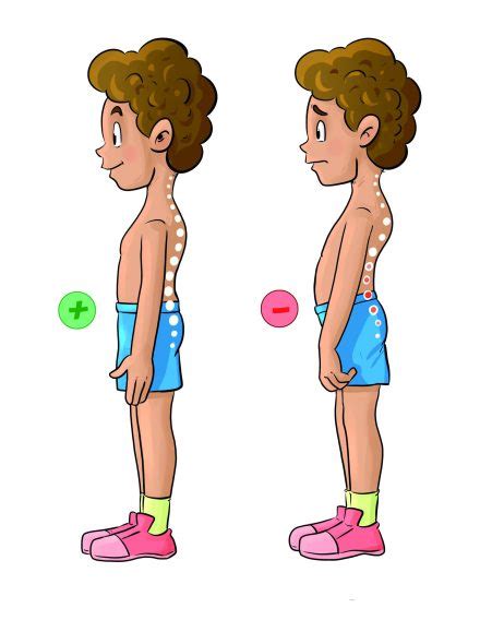 ilustrácia správneho a nesprávneho držania tela