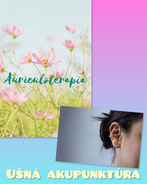 Ilustrácia bodov ušnej akupunktúry