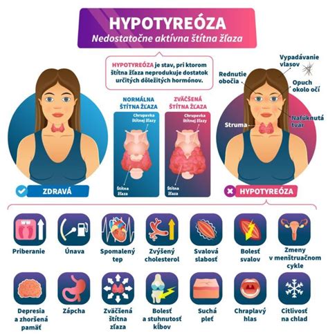 Infografika znázorňujúca telesné systémy, ktoré ovplyvňujú metabolizmus a chudnutie (štítna žľaza, tráviaci trakt, hormonálny systém)