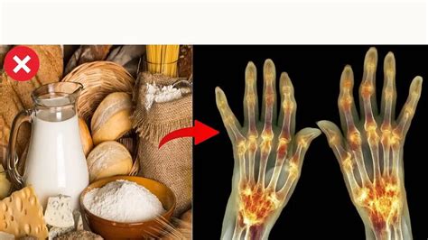 Ilustrácia rôznych typov nezdravých potravín, ktorým sa pri chudnutí vyhnúť.