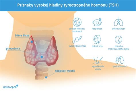 Schéma štítnej žľazy v tvare motýľa v oblasti krku