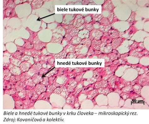 Mikroskopický pohľad na tukové bunky a ich vplyv na zápal