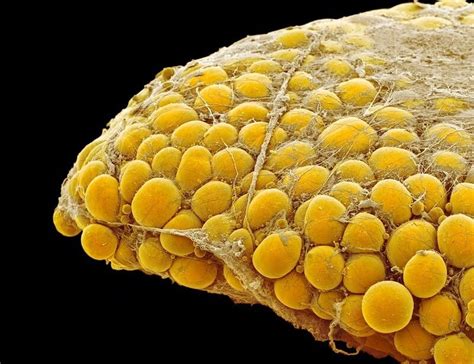 Schéma pôsobenia ultrazvukových vĺn na tukové bunky pri zachovaní okolitých tkanív