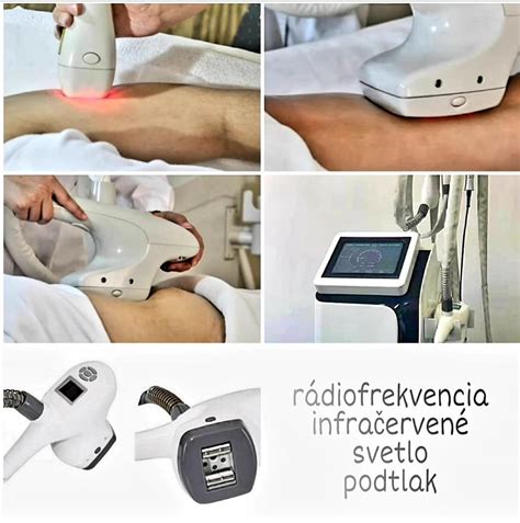 Tematické foto rádiofrekvenčnej liposukcie