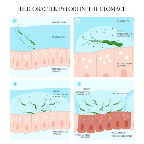 Schéma diagnostických metód Helicobacter pylori