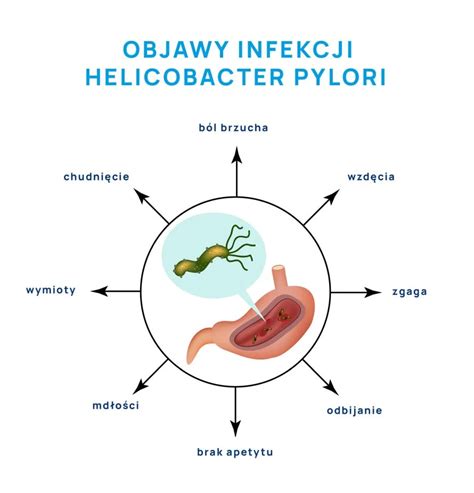 Infografika: Diéta pri Helicobacter pylori (povolené a zakázané potraviny)