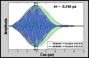 Schéma ultrazvukovej kavitácie: ultrazvukové vlny, tukové bunky, mikrobubliny