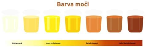 infografika: dôležitosť pitného režimu a farba moču