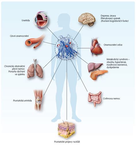 Schéma vplyvu diabetu na rôzne orgánové systémy