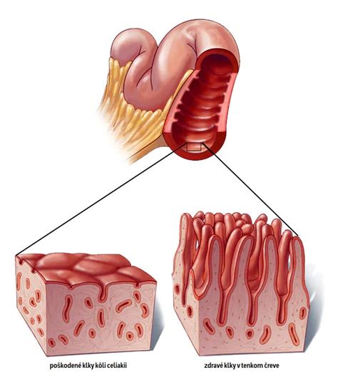 Schéma zobrazujúca funkciu enzýmu DAO pri rozklade histamínu v tenkom čreve