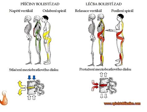 Infografika zobrazujúca princíp špirálnej stabilizácie chrbtice v SM systéme